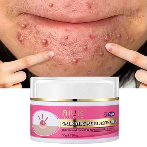 High Quality Facial Moisturizer Salicylic Acid Acne Scar Removal Cream Best Organic Anti Acne Face Cream