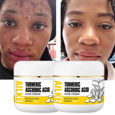 High Quality Facial Moisturizer Salicylic Acid Acne Scar Removal Cream Best Organic Anti Acne Face Cream